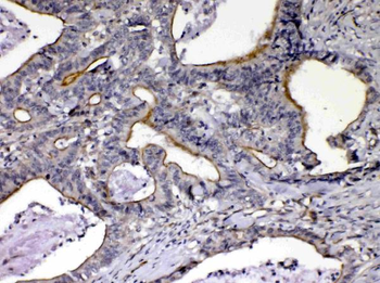 Anti-NOV/CCN3 Antibody