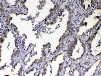 Anti-NOV/CCN3 Antibody