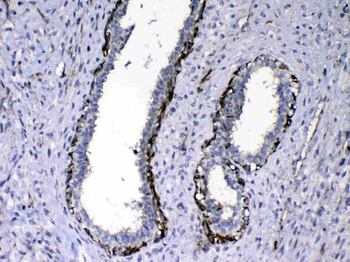 Anti-NOV/CCN3 Antibody