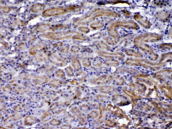Anti-NOV/CCN3 Antibody