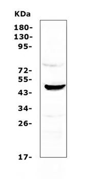 Anti-NOV/CCN3 Antibody