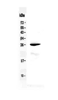 RND1 Rabbit Polyclonal Antibody