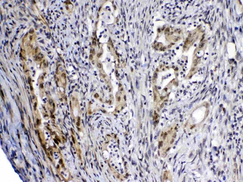 Anti-MED4 Antibody