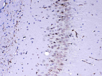 Anti-MED4 Antibody