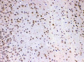 Anti-MED4 Antibody