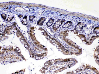 Anti-MED4 Antibody