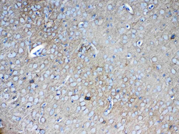 Anti-Neurocan/NCAN Antibody