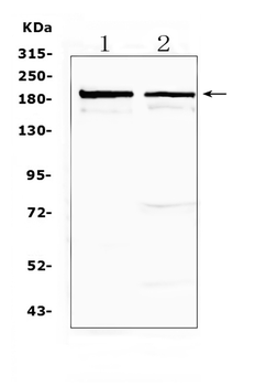 Anti-Neurocan/NCAN Antibody