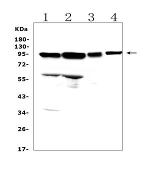 Anti-AMOTL2 Antibody