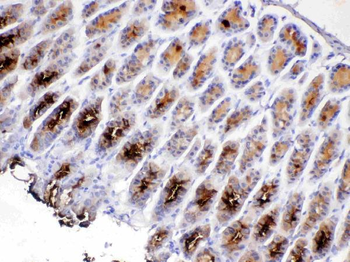 TFF2 Antibody