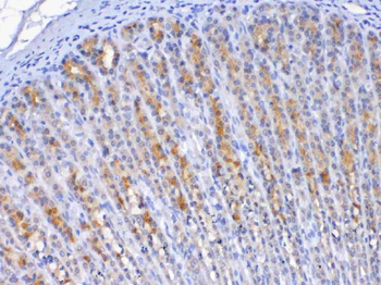 Anti-TFF2 Antibody