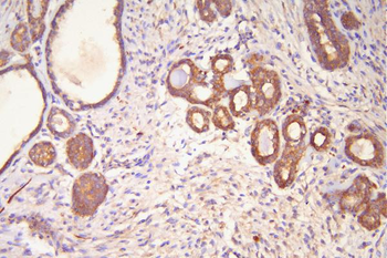 Anti-Hsp20/HSPB6 Antibody