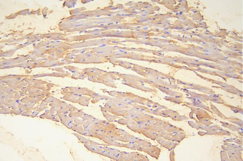 Anti-Hsp20/HSPB6 Antibody