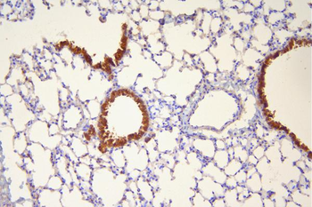 Anti-Hsp20/HSPB6 Antibody