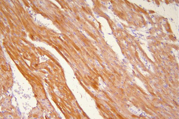 Anti-Hsp20/HSPB6 Antibody