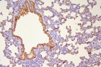 Anti-Hsp20/HSPB6 Antibody