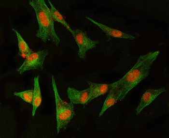 Anti-MED8 Antibody