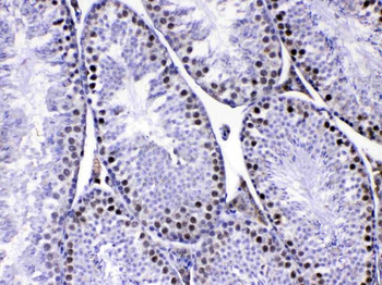 Anti-MED8 Antibody