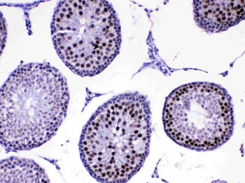 Anti-MED8 Antibody