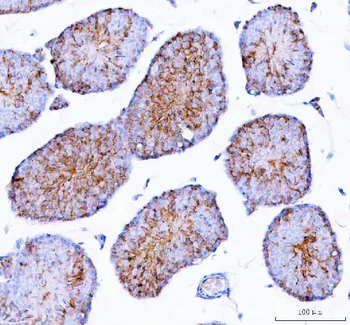Anti-Epigen/Epgn Antibody