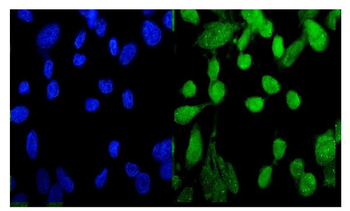 Anti-MED9 Antibody