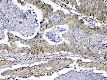 Anti-MED9 Antibody
