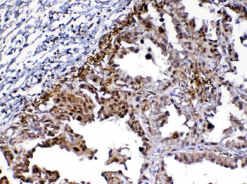 Anti-MED9 Antibody