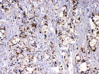 Anti-MED9 Antibody