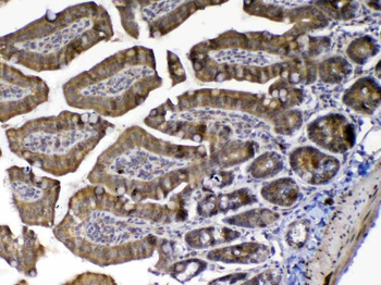 Anti-MED9 Antibody