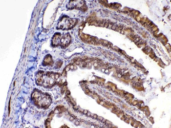 Anti-MED9 Antibody
