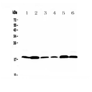 Anti-MED9 Antibody