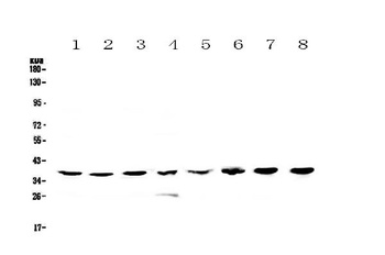 hnRNP A2B1/HNRNPA2B1 Antibody