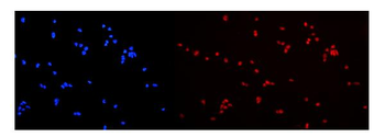 Anti-hnRNP A2B1/HNRNPA2B1 Antibody