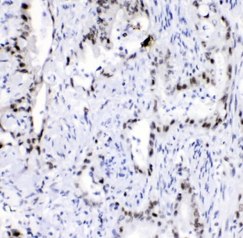 Anti-hnRNP A2B1/HNRNPA2B1 Antibody