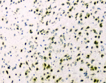 Anti-hnRNP A2B1/HNRNPA2B1 Antibody