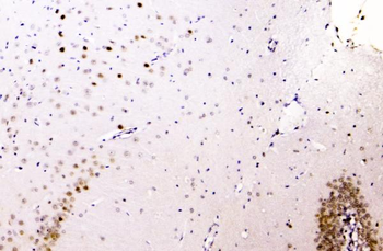 Anti-hnRNP A2B1/HNRNPA2B1 Antibody