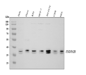 Anti-hnRNP A2B1/HNRNPA2B1 Antibody