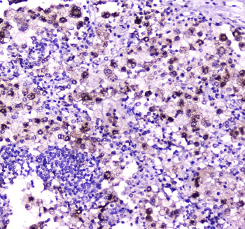 Anti-Niemann Pick C2/NPC2 Antibody