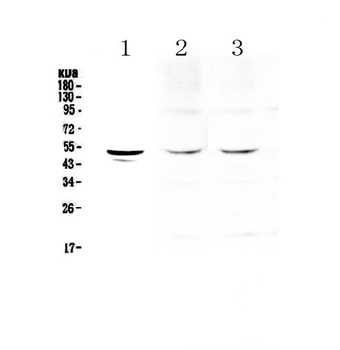 Tryptophan Hydroxylase/TPH1 Antibody