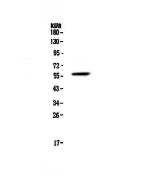FGR Rabbit Polyclonal Antibody