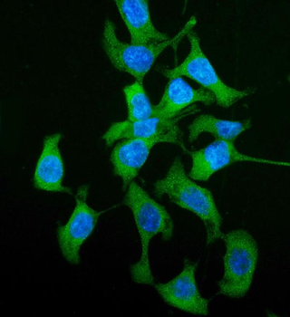 Anti-HGD Antibody