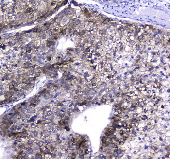 Anti-HGD Antibody