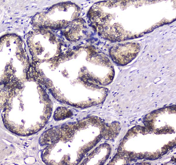 Anti-HGD Antibody