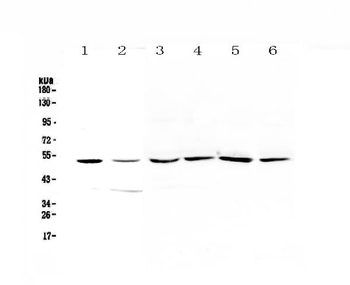 Anti-HGD Antibody