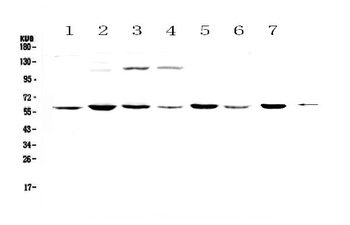 Nicotinic Acetylcholine Receptor alpha 3/CHRNA3 Antibody