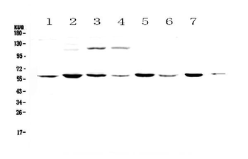 Anti-Nicotinic Acetylcholine Receptor alpha 3/CHRNA3 Antibody