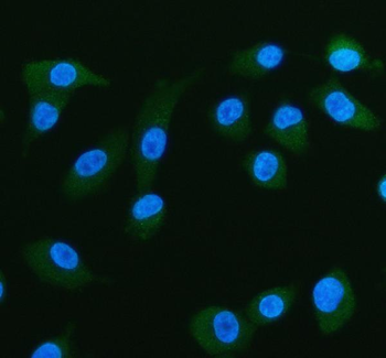 Fatty Acid Binding Protein 5/FABP5 Antibody