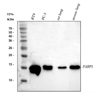 Anti-Fatty Acid Binding Protein 5/FABP5 Antibody