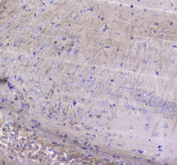 Anti-Betacellulin/Btc Antibody