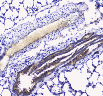 Anti-Betacellulin/Btc Antibody